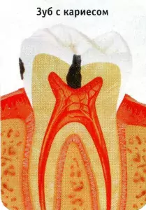 Что важно знать о здоровье ваших зубов и десен