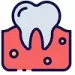лечение зубных каналов